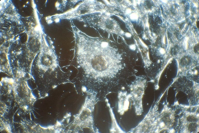 Mature Cells May Play an Important Role in the Onset of Cancer