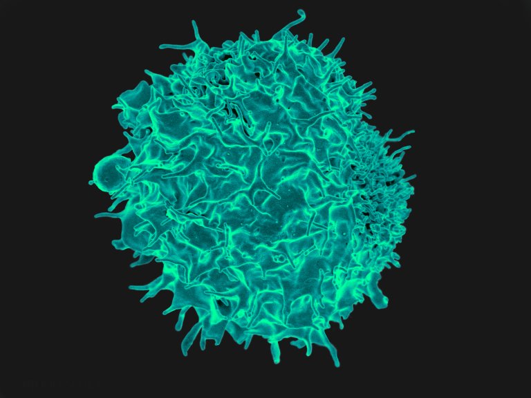 New CAR-T Cancer Studies Aim to Treat Those With No Other Options