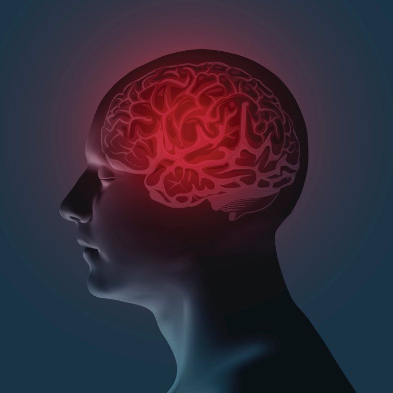 migraine migraine prevention drug treatment