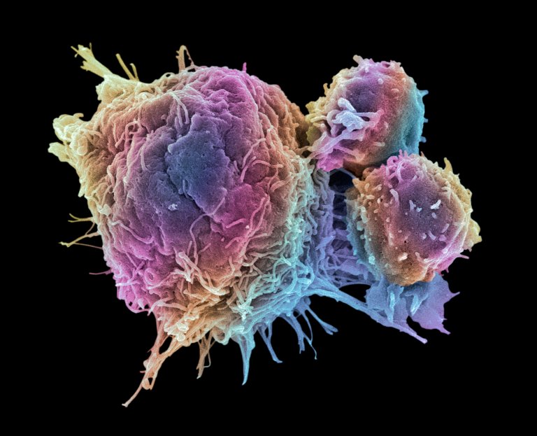 Breakthrough Cancer Test Identifies Which of 15 Drugs Most Likely to Eradicate Tumors