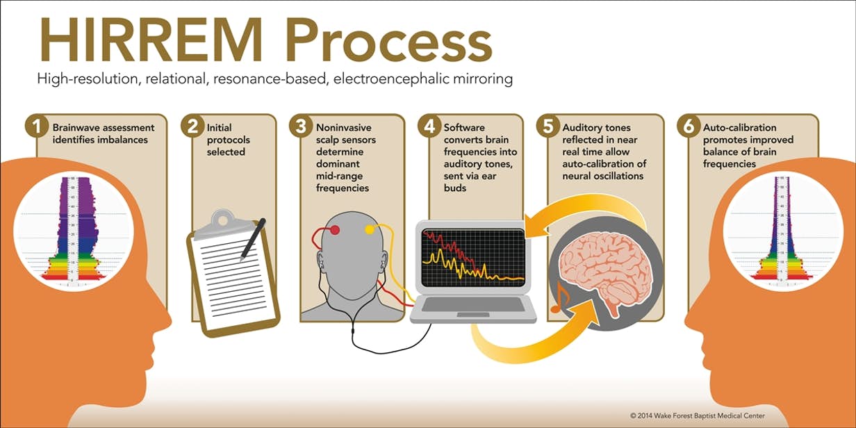 The HIRREM Process. Image Credit: Wake Forest Baptist Medical Center