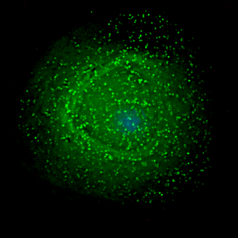 Thanks to a New Study, We May Be Able to Stop HIV in Its Tracks