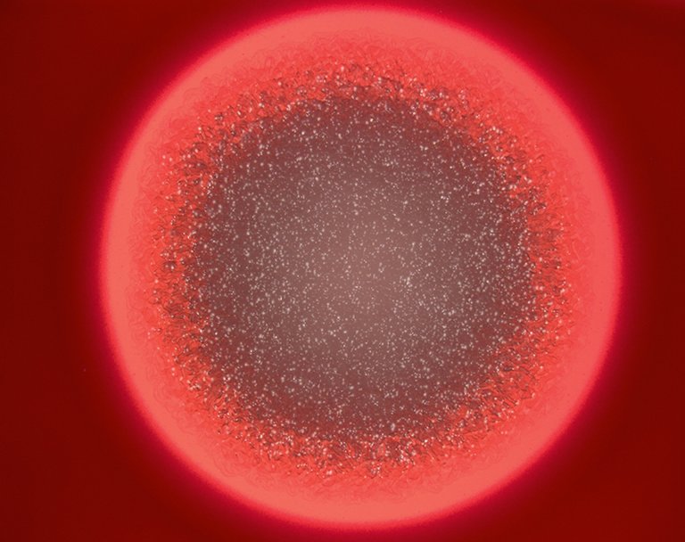 An AI-Equipped Microscope Can Diagnose Deadly Blood Infections