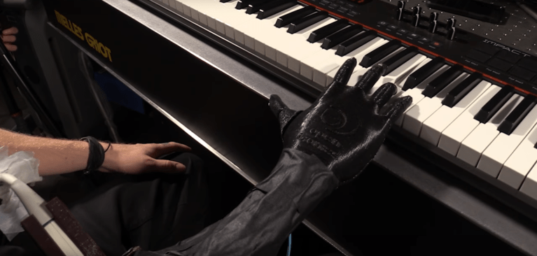 prosthetic amputee robotics ultrasound