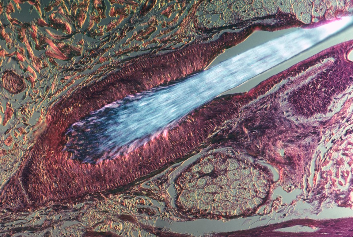 skin stem cells stem cell research skin cancer