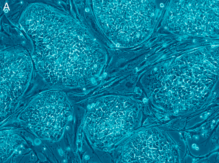 Newly FDA-Approved Platform Will Rapidly “Manufacture” Stem Cells to Repair Our Bodies