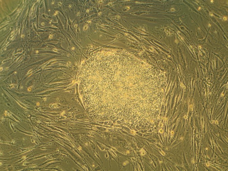 Scientists Grow First-Ever Working Human Muscle From Stem Cells