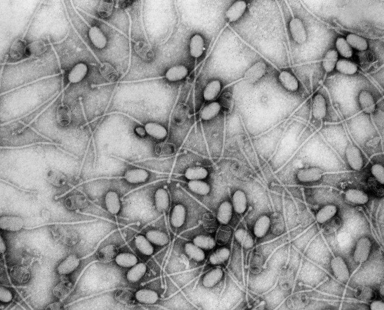 Artificial Intelligence Can Support Killer Viruses in the War Against Superbugs