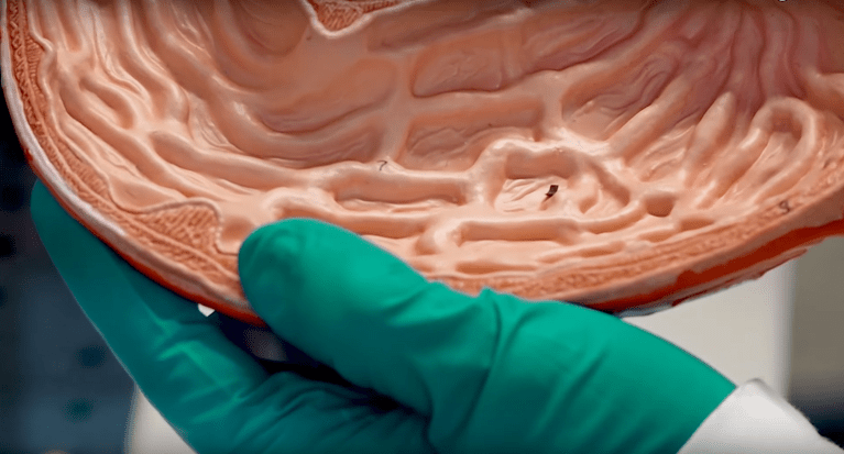 Incredibly Mobile “Minimalist Robot” Could Be the Future of Non-Invasive Medicine