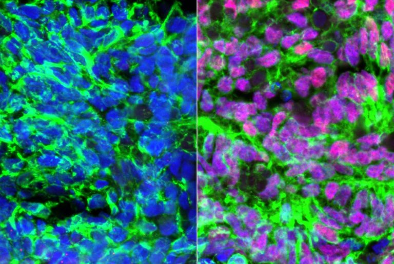 Scientists Coax Human Stem Cells Into Becoming Touch Neurons