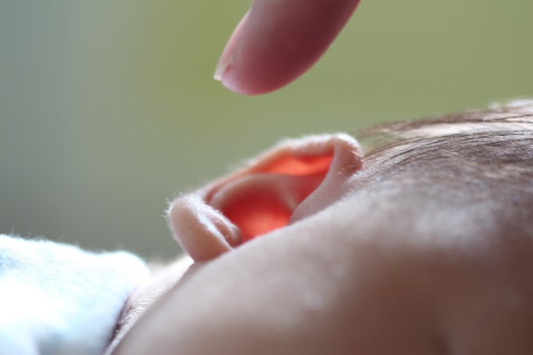 medical microtia china developmental disorder