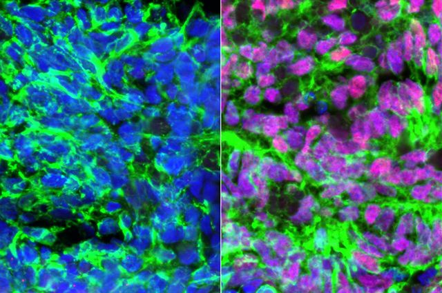 Human embryonic stem cell-derived neurons (green) showing nuclei in blue. Each side shows a different mixture to try to create sensory interneurons. Image Credit: UCLA Broad Stem Cell Research Center/Stem Cell Reports