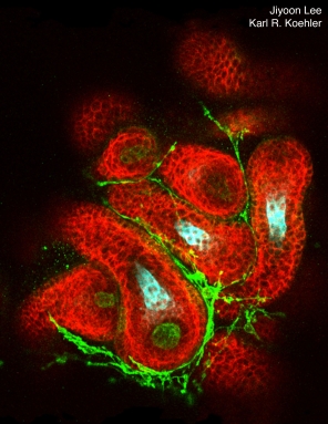 Hair follicles (red) grow out of spherical skin organoids. Image Credit: Jiyoon Lee and Karl R. Koehler.