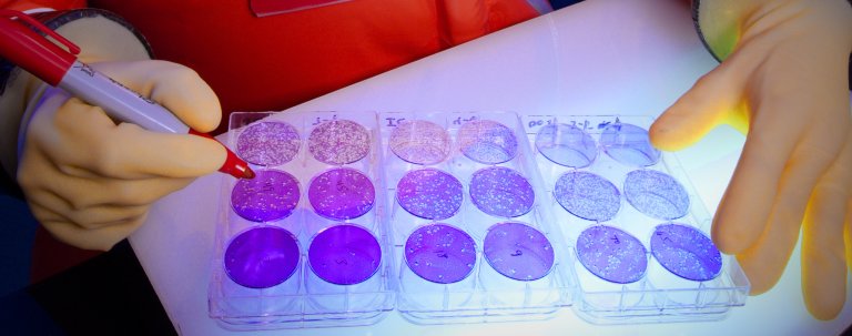 The CDC Has Requested a $400-Million Lab to House Deadly Microbes