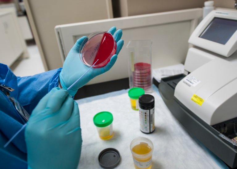 alzheimer's disease memory loss blood test preventative medicine