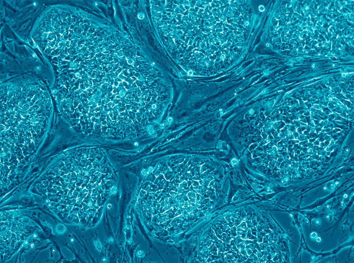 cancer vaccine