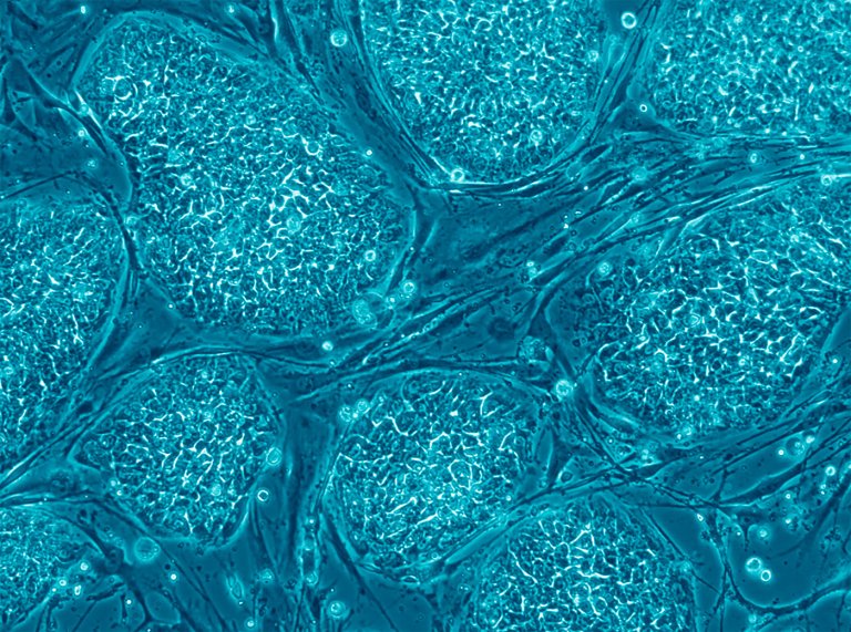 cancer vaccine