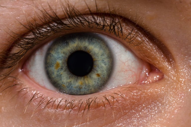 eyedrops corneas nearsighted farsighted