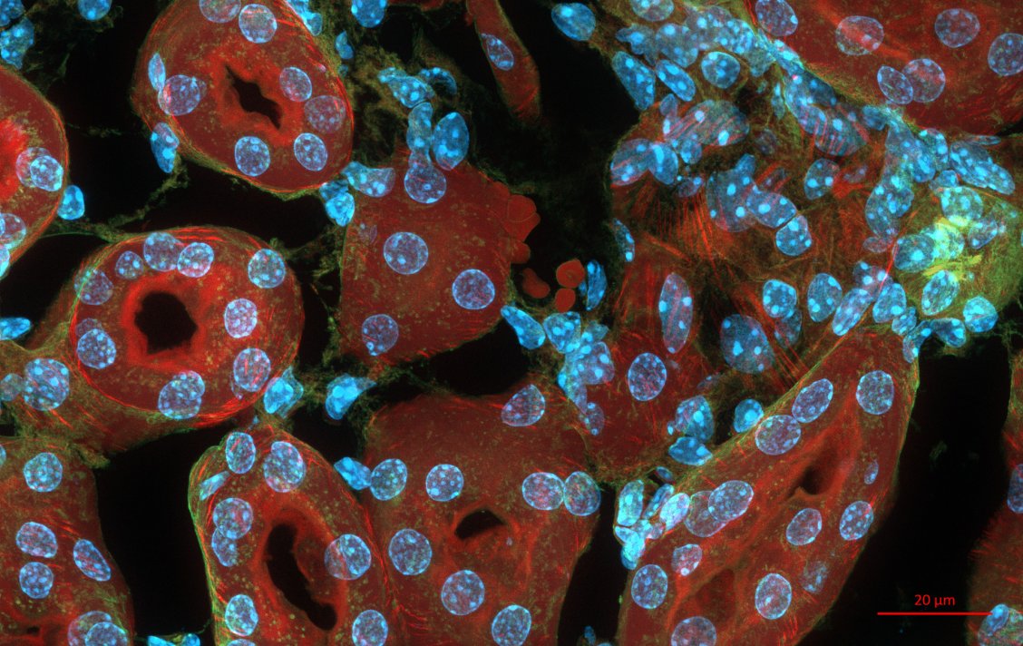 We Can Now Use Stem Cells to Grow Functioning Kidney Tissue