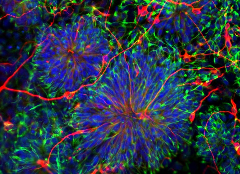 Startup Proposes Using Stem Cells From Placentas for Regenerative Medicine