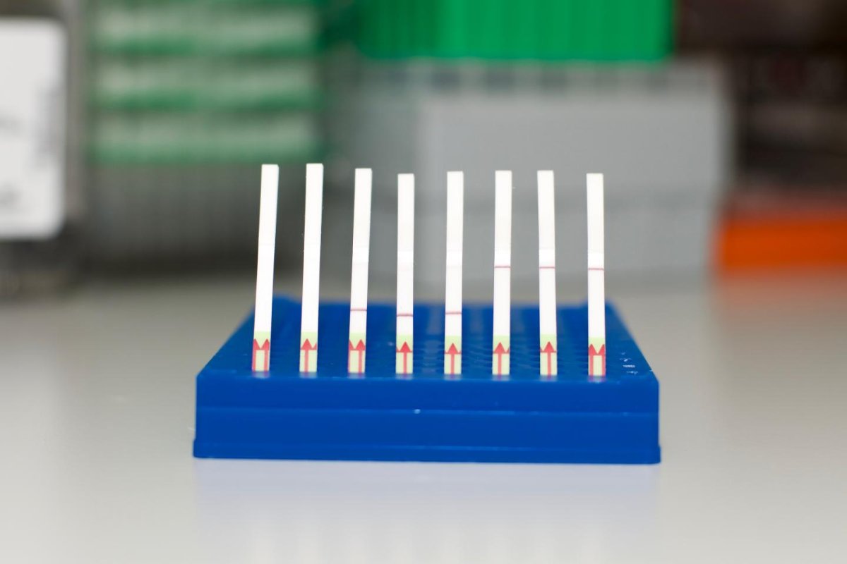 SHERLOCK Paper Test Strips. First 2 strips are unused; middle three show negative readings; final three show positive readings. Image Credit: Zhang lab, Broad Institute of MIT and Harvard