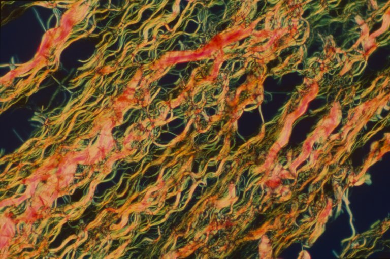 A New Discovery About Human Skin Could Help Us Eliminate Scarring