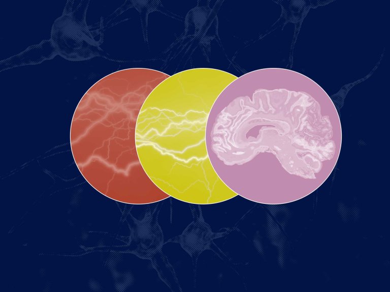 Can a Brain Zap Really Boost Your Memory?