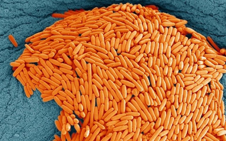 Fecal Transplants See Success in 90 Percent of Bacterial Gut Infections