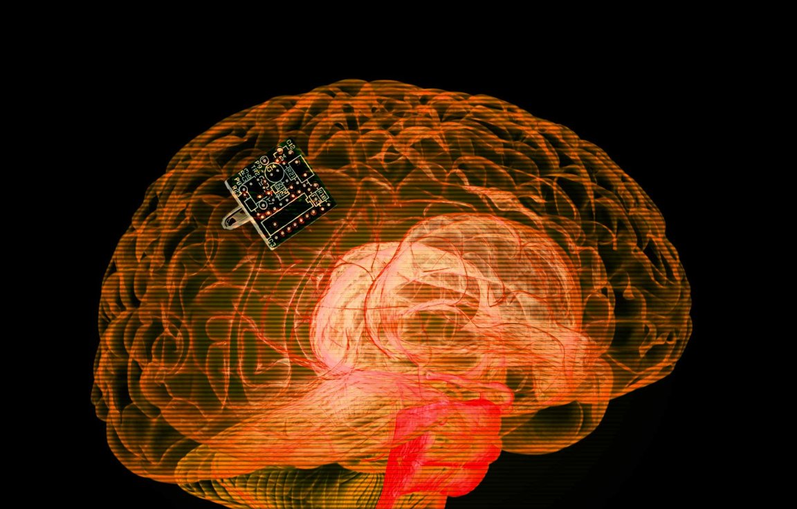 bci neuralink eeg medical tech
