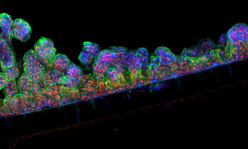 After being placed in a chip, intestine lining cells form folds like they do in the human body. Image Credit: Cedars-Sinai Board of Governors Regenerative Medicine Institute