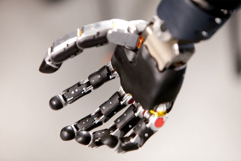 Florida Man Becomes First Person to Live With Advanced Mind-Controlled Robotic Arm