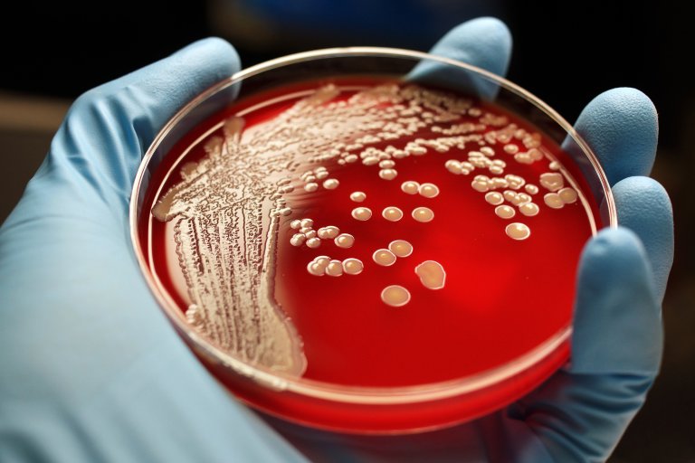 Antibiotic Resistance Has Made Another Dangerous “Jump” Between Species