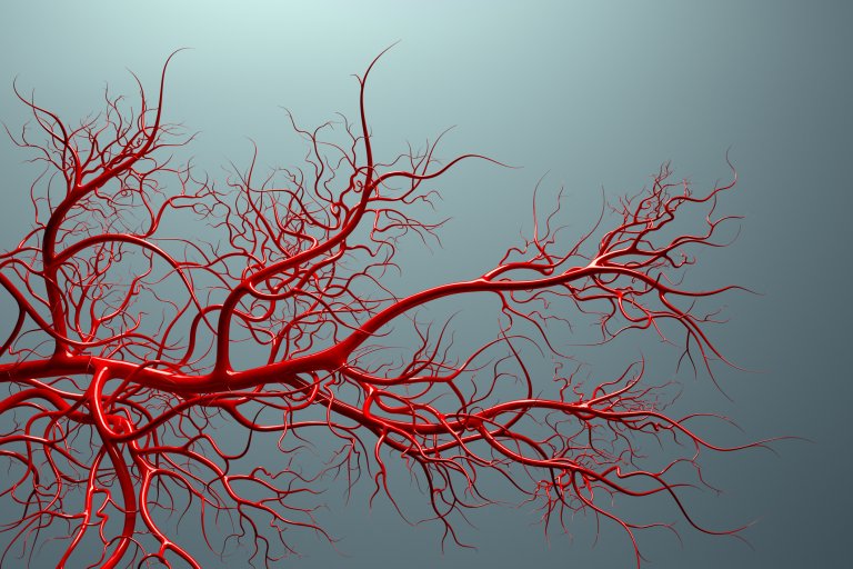 Growing New Veins Could Make Life Better for People on Dialysis