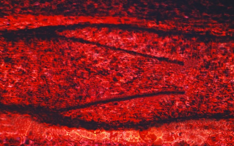 What Is “Superblood,” and Why Do I Want It?