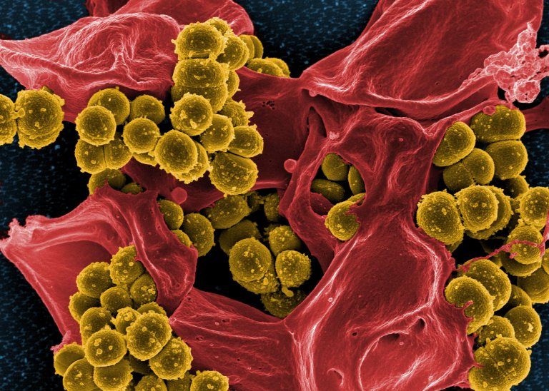A Synthetic Microbe Could Be the Next Antibiotic