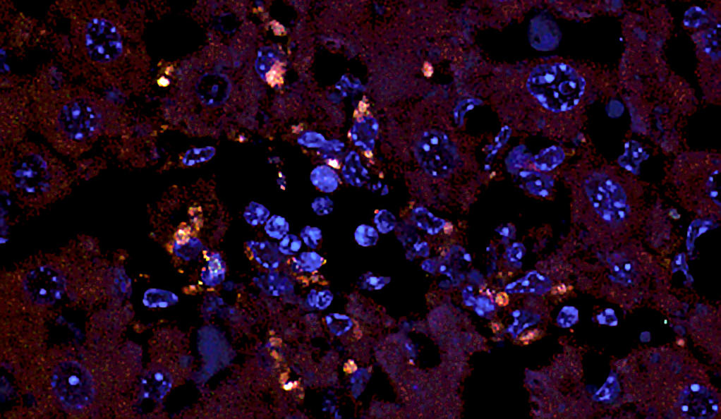 The bacteria Enterococcus gallinarum, a type gut bacteria that can trigger an immune response when it relocates, appears under a microscope as blue and light orange spots.