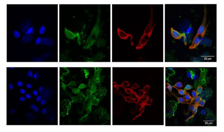 Researchers Are Developing a New Cancer Vaccine Using Virus-Like Particles