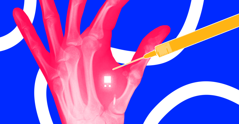 All the Rage in Sweden: Embedding Microchips Under Your Skin