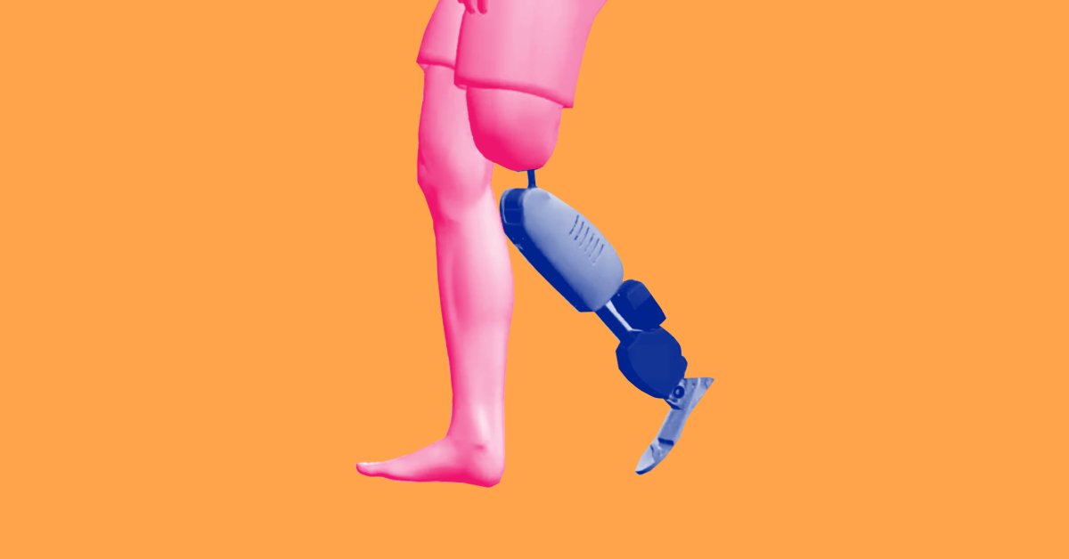 We’ve Reached A New Level In Bionics: Artificial Limbs We Forget Are ...
