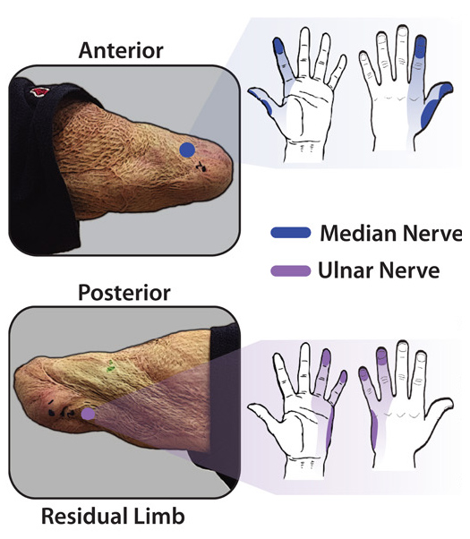 e-dermis