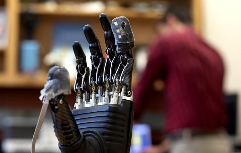 Electronic Skin Lets Amputees Feel Pain Through Their Prosthetics
