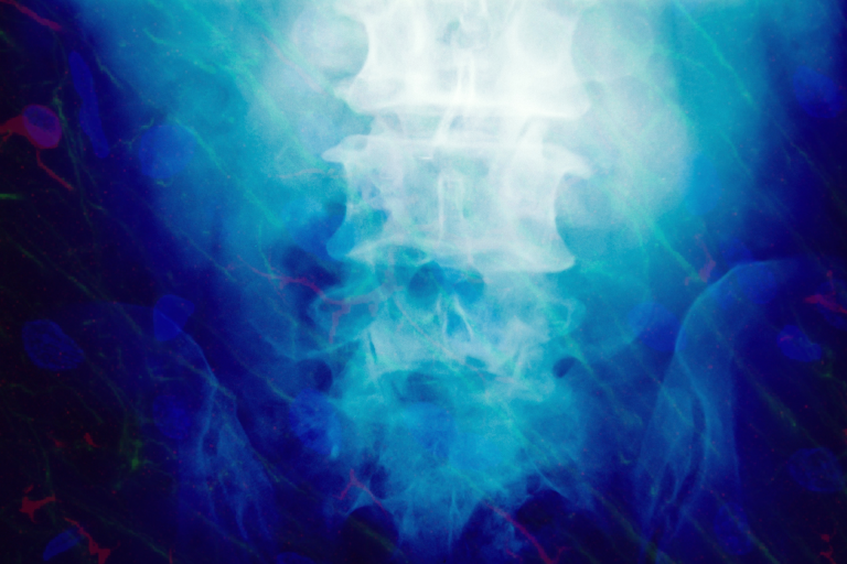 New Gene Therapy Could Stitch Together Damaged Spinal Cords