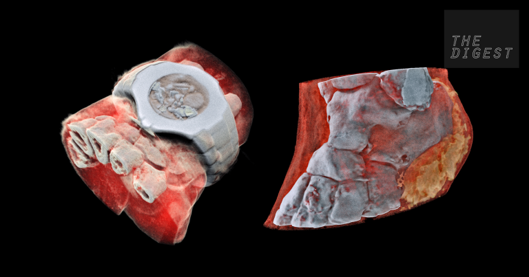 The Digest: These Mind-Blowing Images of The Human Body Were Made By A New Kind of Scanner