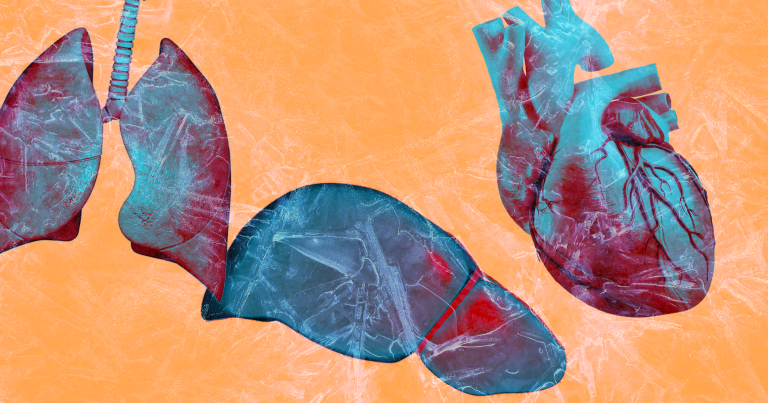 Freezing And Storing Donated Organs Could Eliminate Some Transplant Waitlists