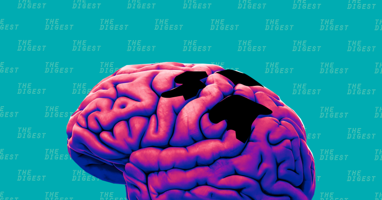 Anew AI developed by MIT researchers can prescribe the minimum effective dose for patient with an aggressive type of brain tumor known as glioblastoma.