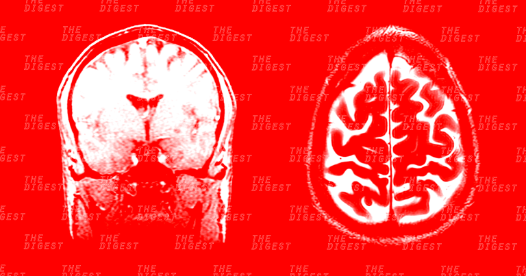 This AI Dreams Up Brain Tumor Scans to Train Other AIs