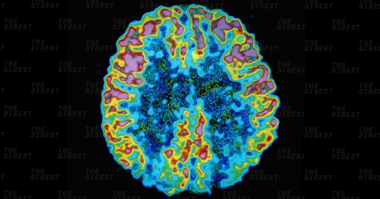 A Researcher Is Offering a Prize to Anyone Who Can Prove a Germ Causes Alzheimer’s