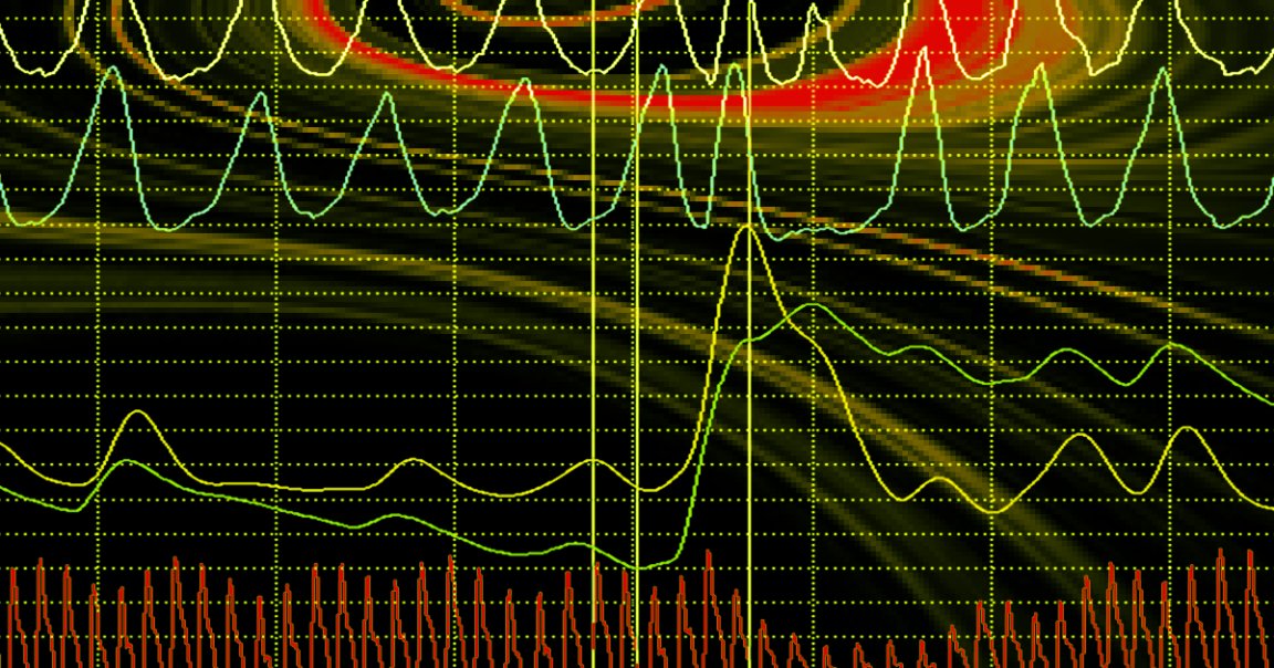 Spain is rolling out an AI lie detector called VeriPol at many of its police stations, which uses machine learning to flag false police reports.