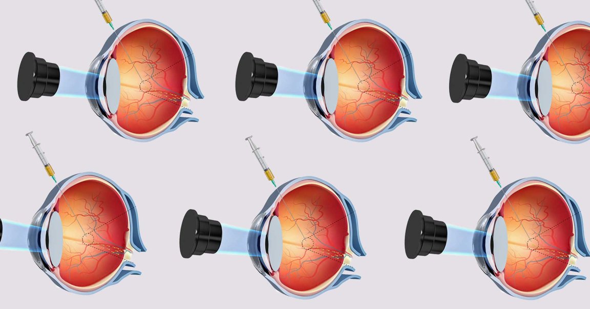 Researchers develop a corkscrew-shaped nanobot they can guide through the dense tissue of an eyeball using a magnetic field.