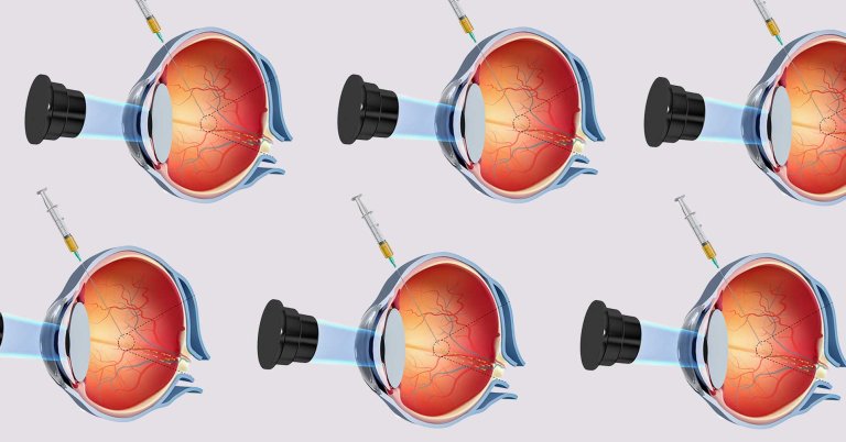 Researchers develop a corkscrew-shaped nanobot they can guide through the dense tissue of an eyeball using a magnetic field.